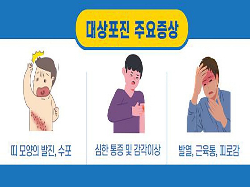 중원구보건소-성남시 대상포진 주요증상 안내 이미지.jpg