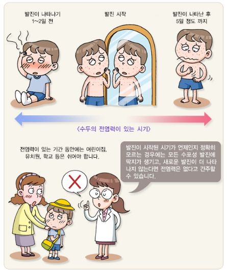 수두 예방 홍보물